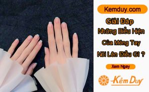giai dap nhung bieu hien mong tay noi len dieu gi