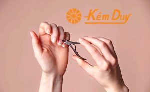 kem cat da bi cun bi set phai lam sao